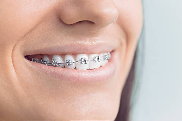 Dental X-Rays and Imaging in Belleview, FL